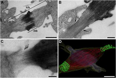 A Structural View on ESCRT-Mediated Abscission